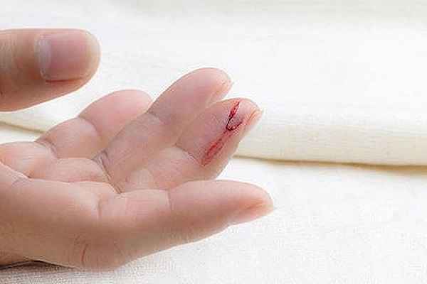 Đứt tay chảy máu là điềm gì?